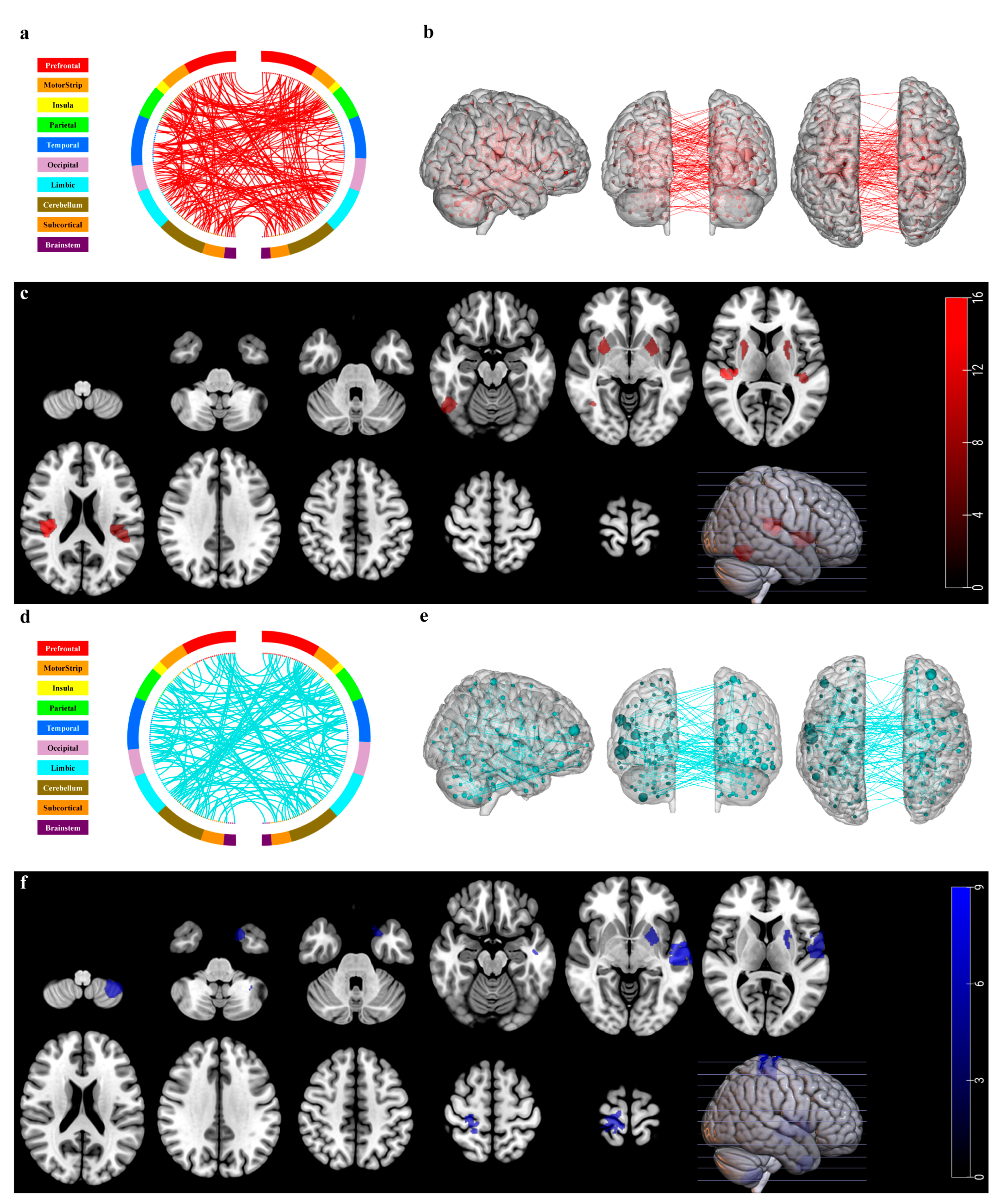 Functional Connectome Predicts Cognition and Links White Matter ...