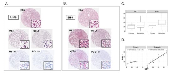 Cancers | Free Full-Text | Correlation of MET and PD-L1 Expression in ...