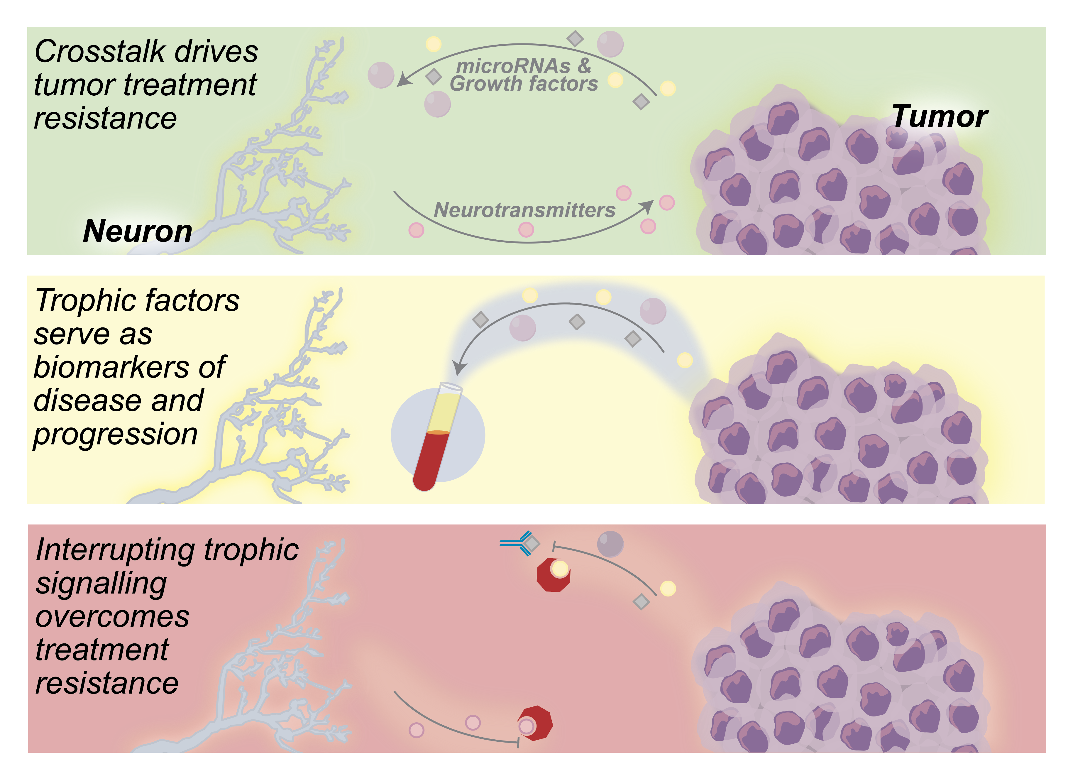 Cancers | Free Full-Text | Interrupting Neuron—Tumor Interactions 