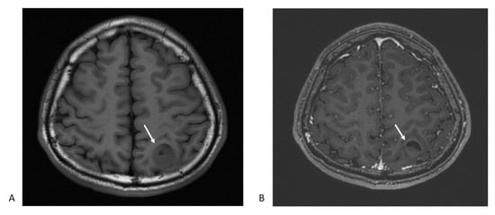 Cancers | Free Full-Text | Nanotechnology And Nanocarrier-Based Drug ...