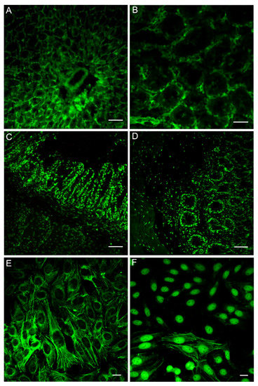 Cancers | Free Full-Text | Autoimmunity Profiles as Prognostic ...