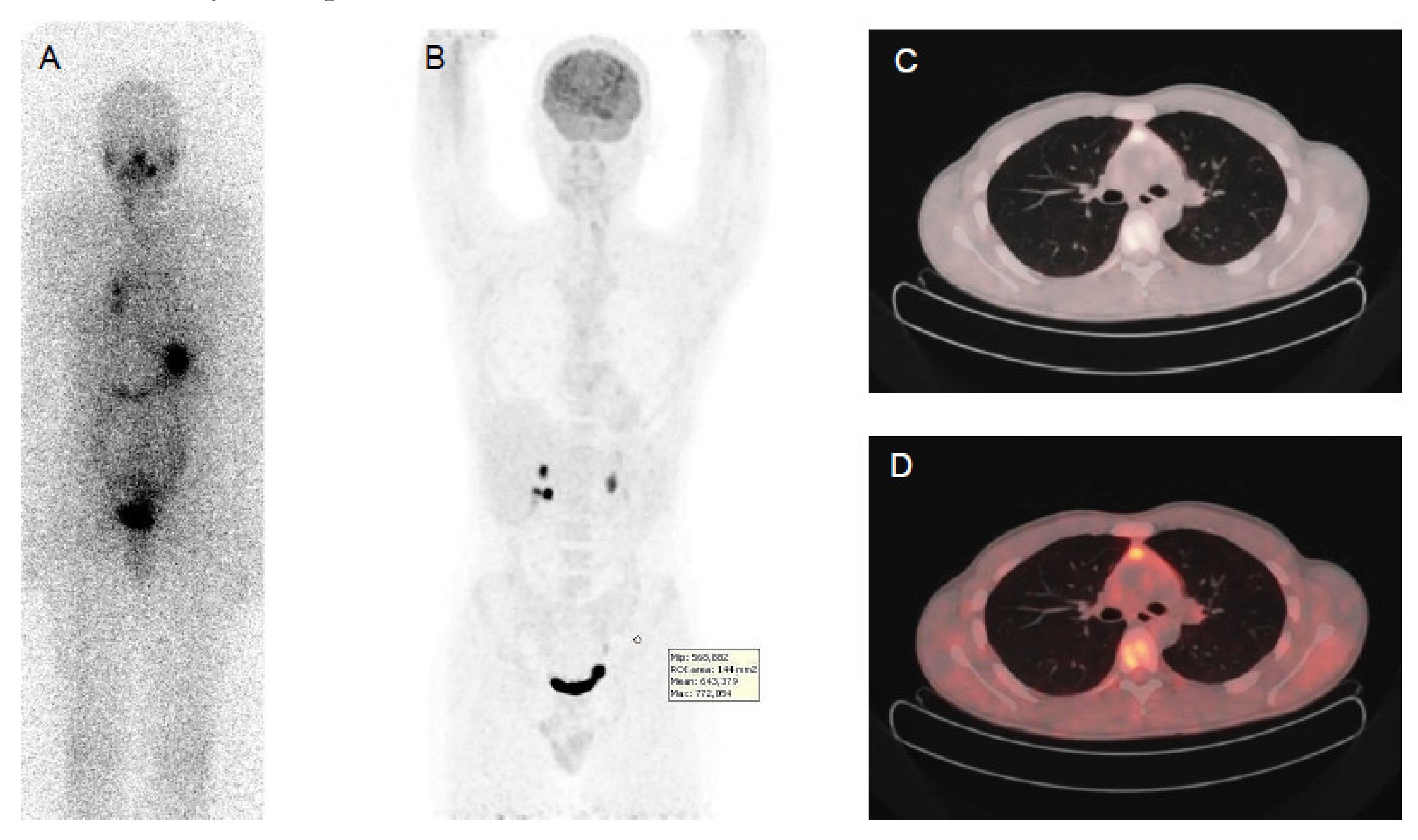 diskret Walter Cunningham berømt Cancers | Free Full-Text | Advances in Functional Imaging of Differentiated Thyroid  Cancer