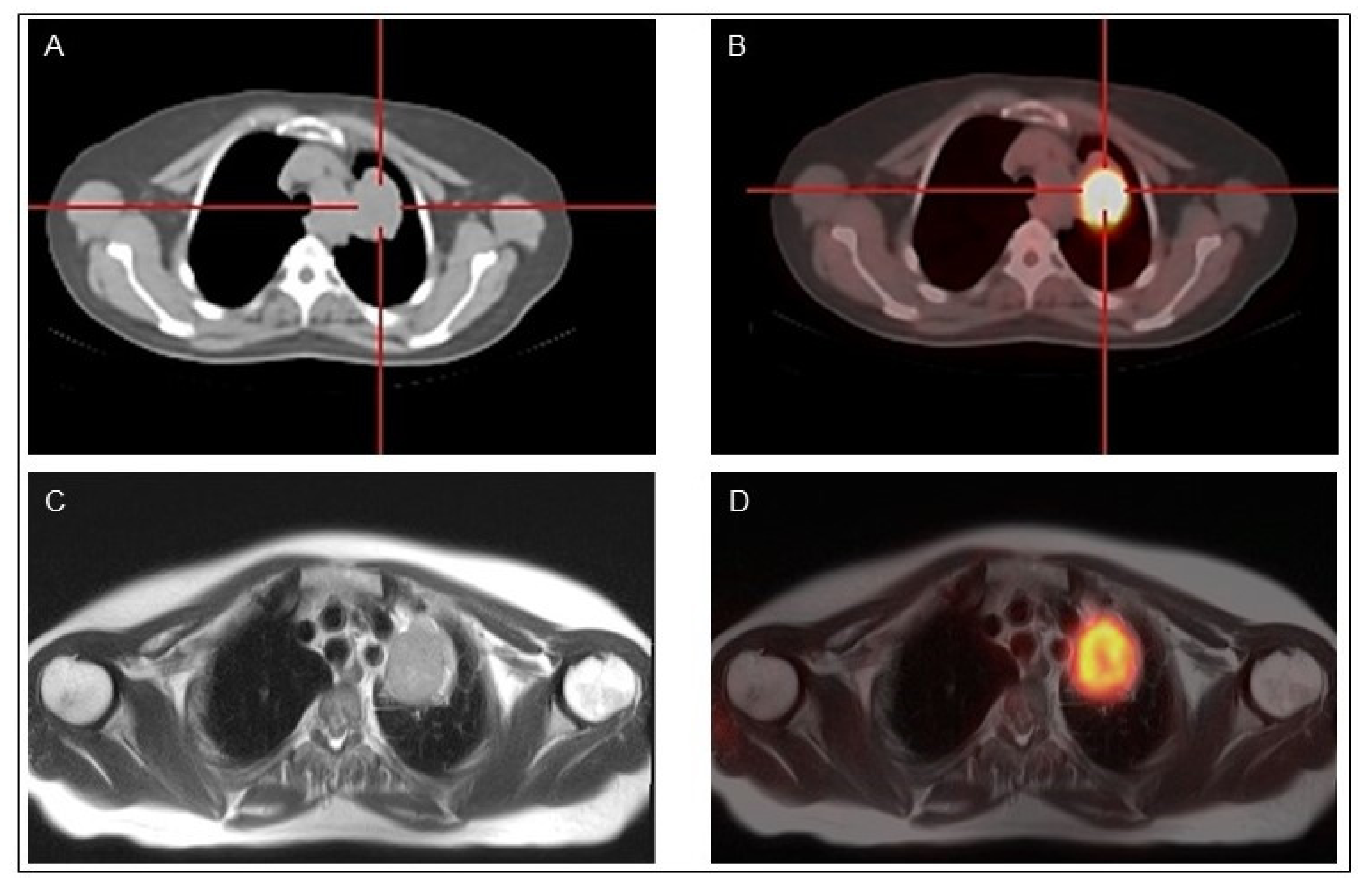 Cancers Free Full Text Advances In Functional Imaging Of