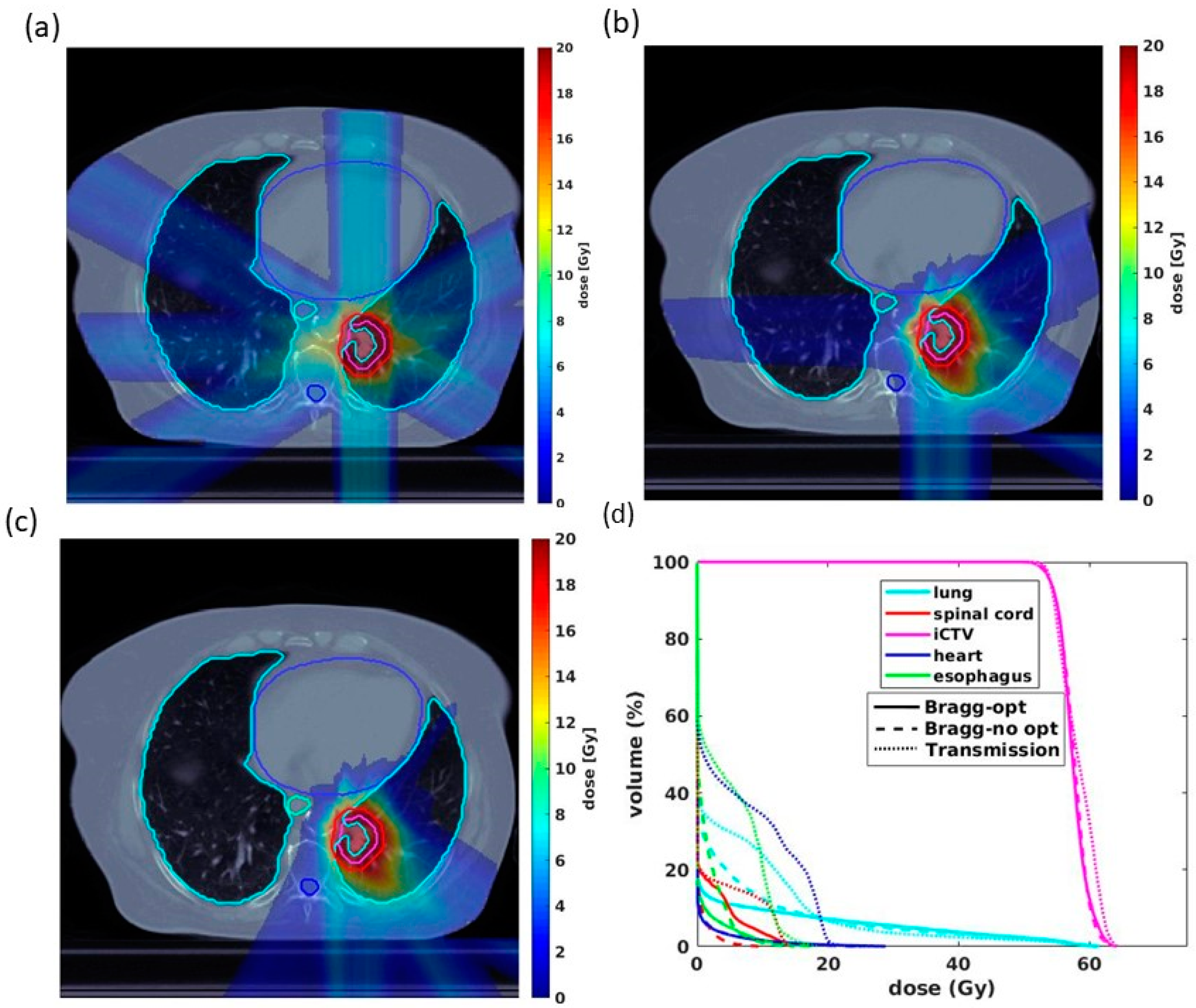 Cancers Free FullText A Novel Proton Pencil Beam Scanning FLASH RT