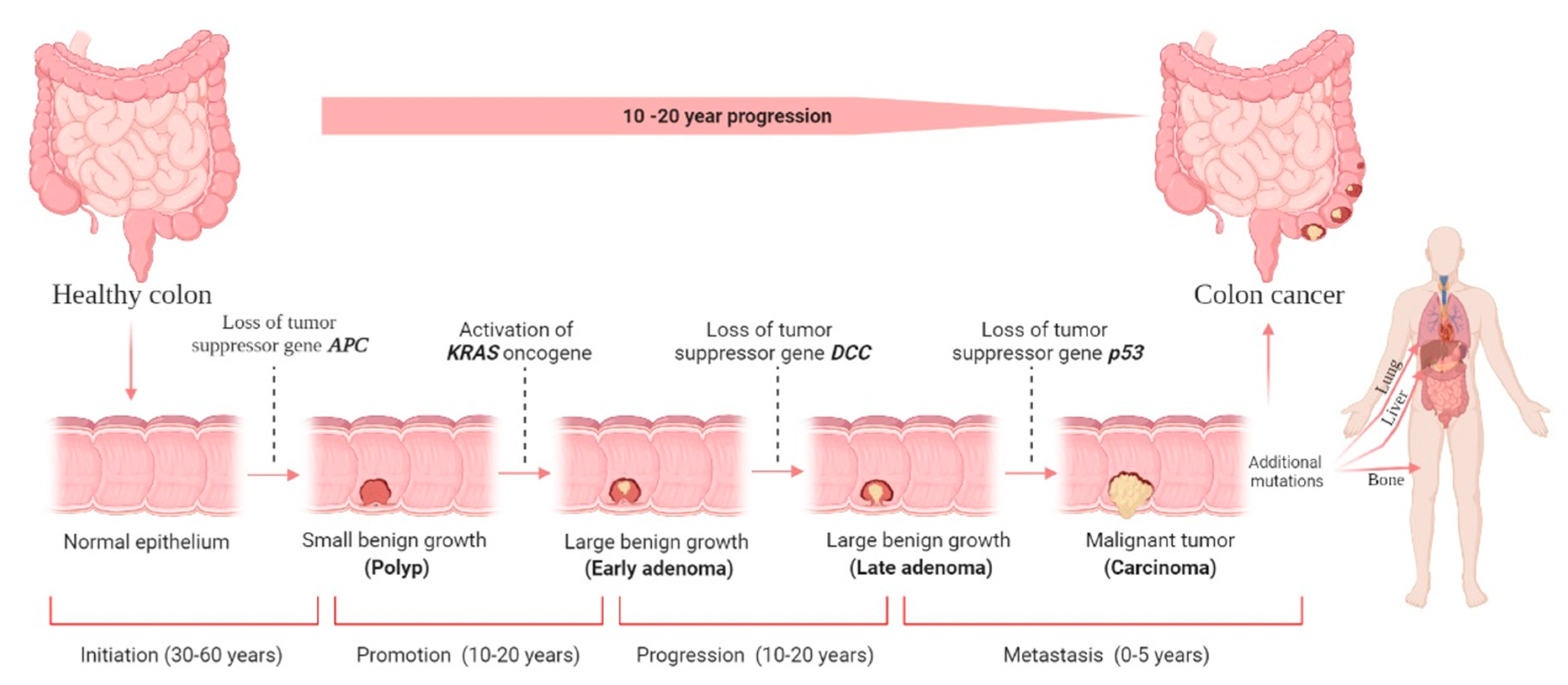 Cancers Free Full Text Colorectal Cancer A Review Of   Cancers 14 01732 G001 