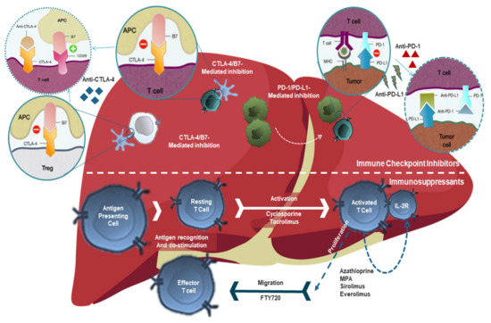 Utilization of Immunotherapy for the Treatment of Hepatocellular ...