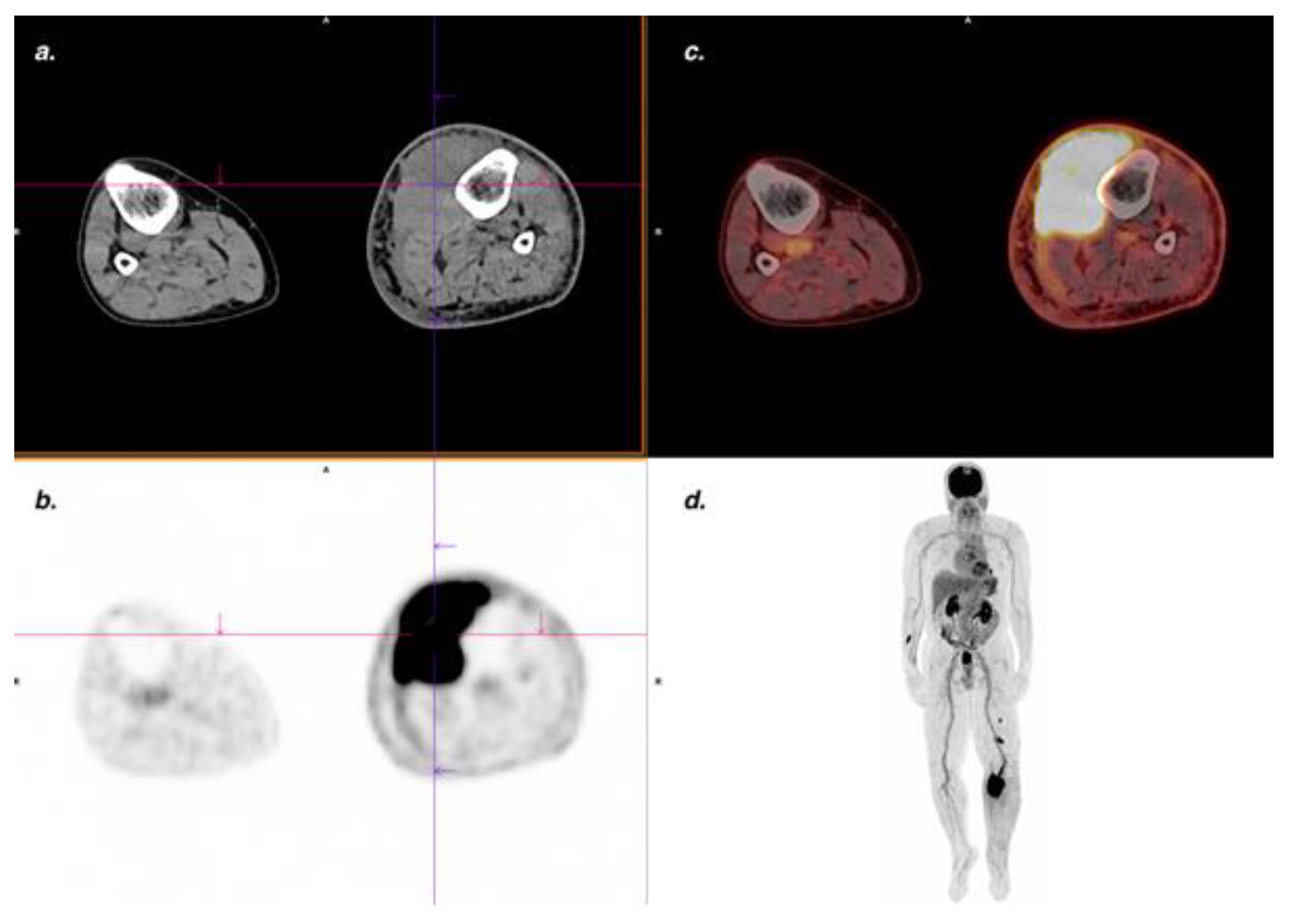 Cancers Free Full Text Yield Of Fdg Petct For Defining The Extent