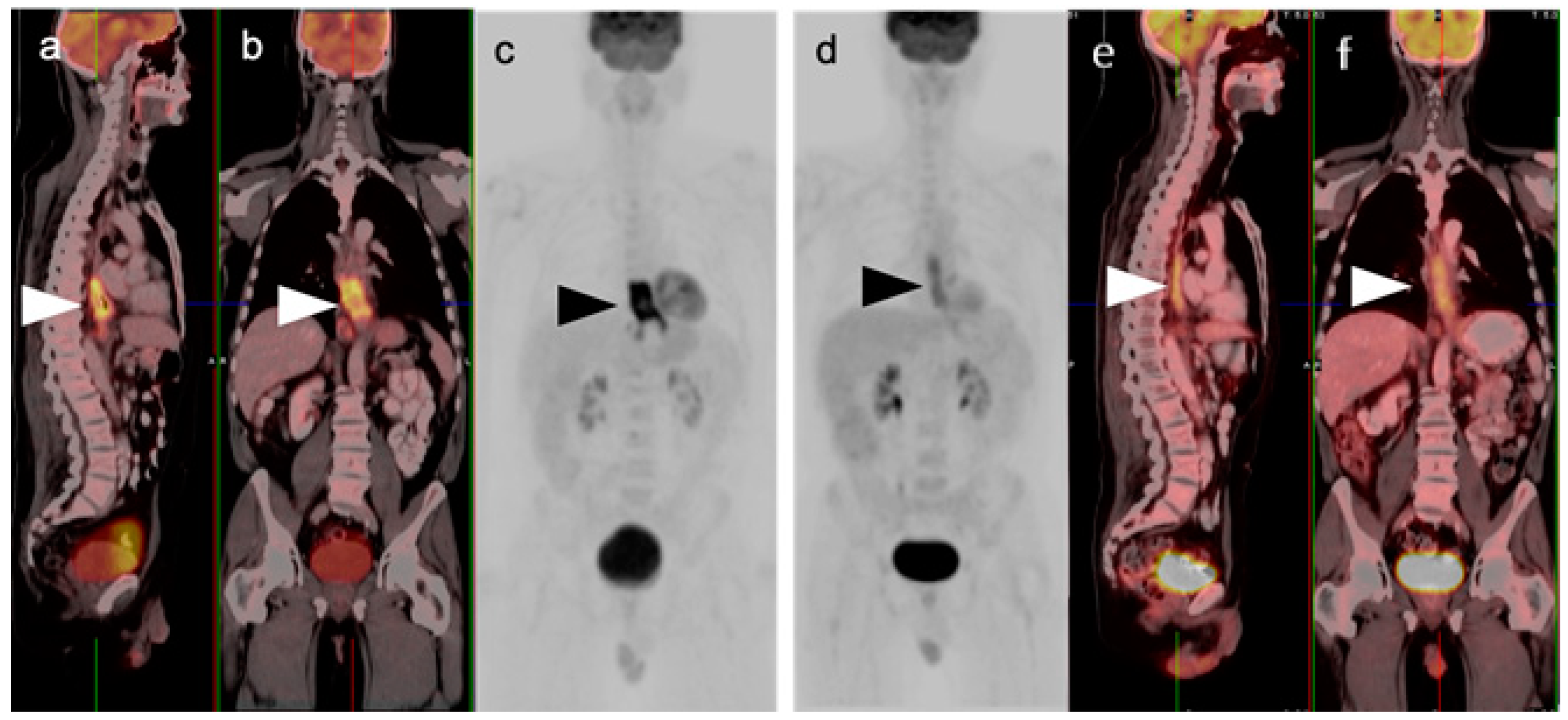 Cancers Free Full Text PET CT In Clinical Adult Oncology III 