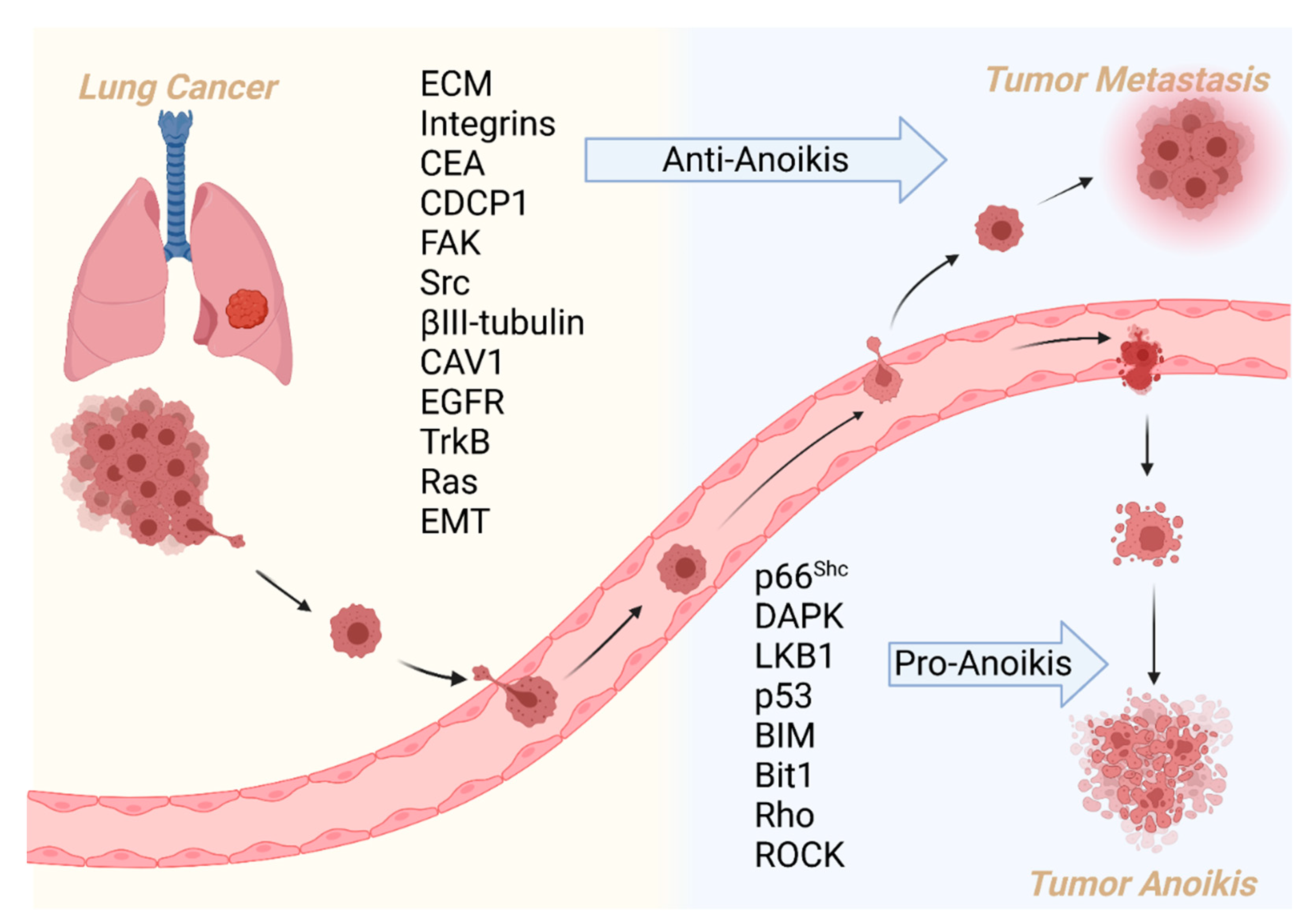 Anoikis Associated Lung Cancer Metastasis Mechanisms And Therapies Anoikis Associated Lung Cancer Metastasis Mechanisms And Therapies