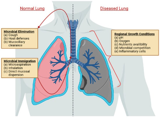 Cancers | Free Full-Text | The Lung Microbiota and Lung Cancer: A ...