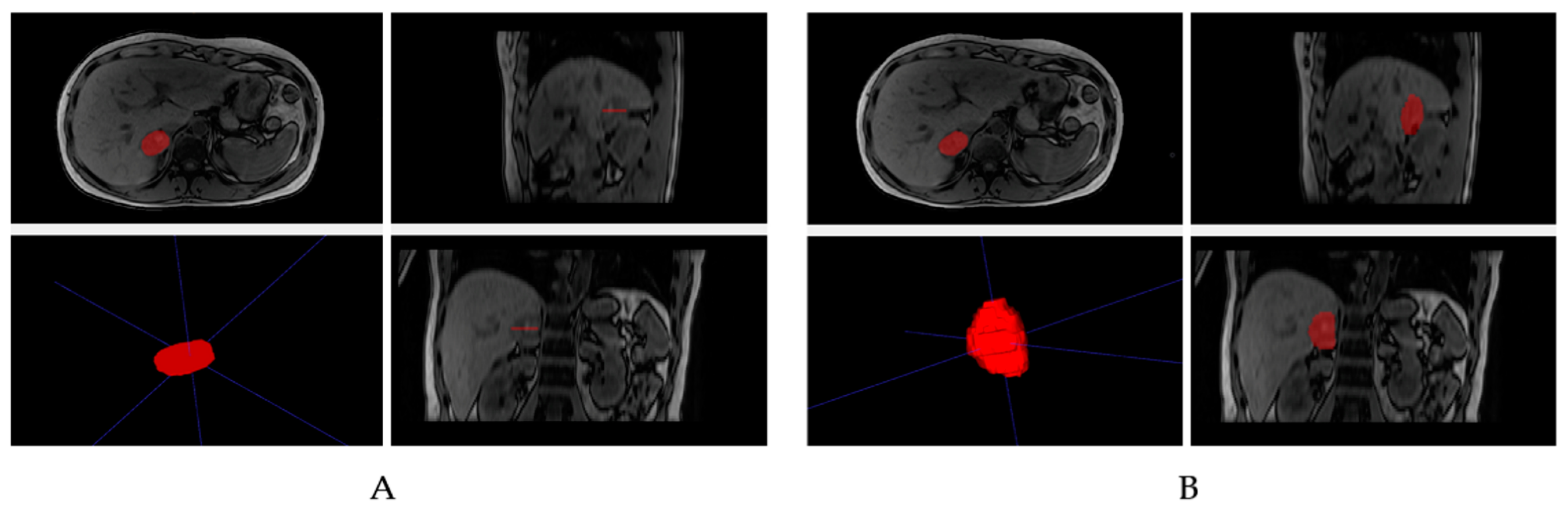 Cancers Free Full Text Oncologic Imaging And Radiomics A