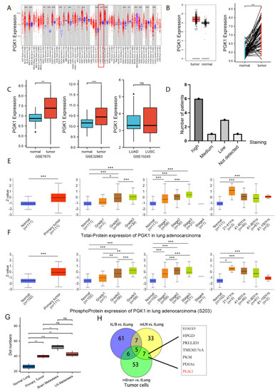 Cancers | Free Full-Text | Prognosis and Immunological Characteristics ...