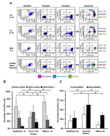 Cancers | Free Full-Text | A High Percentage of CD16+ Monocytes