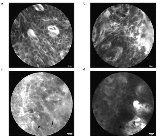 Cancers | Free Full-Text | Confocal Laser Endomicroscopy for 