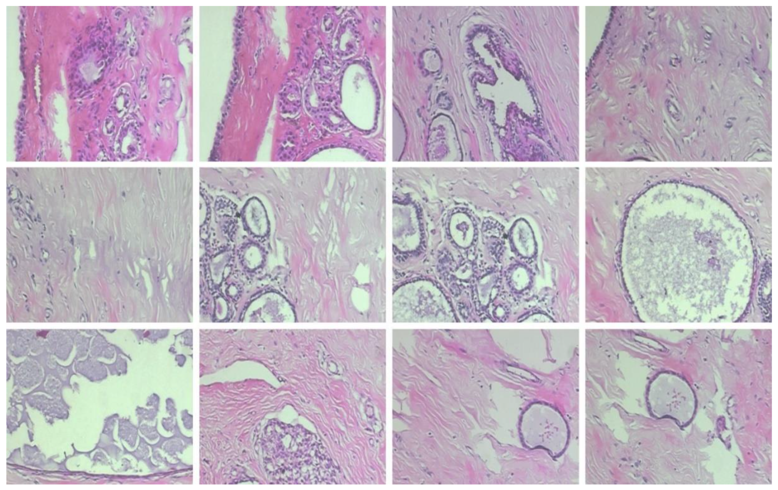 Classification of breast cancer using a manta-ray foraging optimized  transfer learning framework [PeerJ]