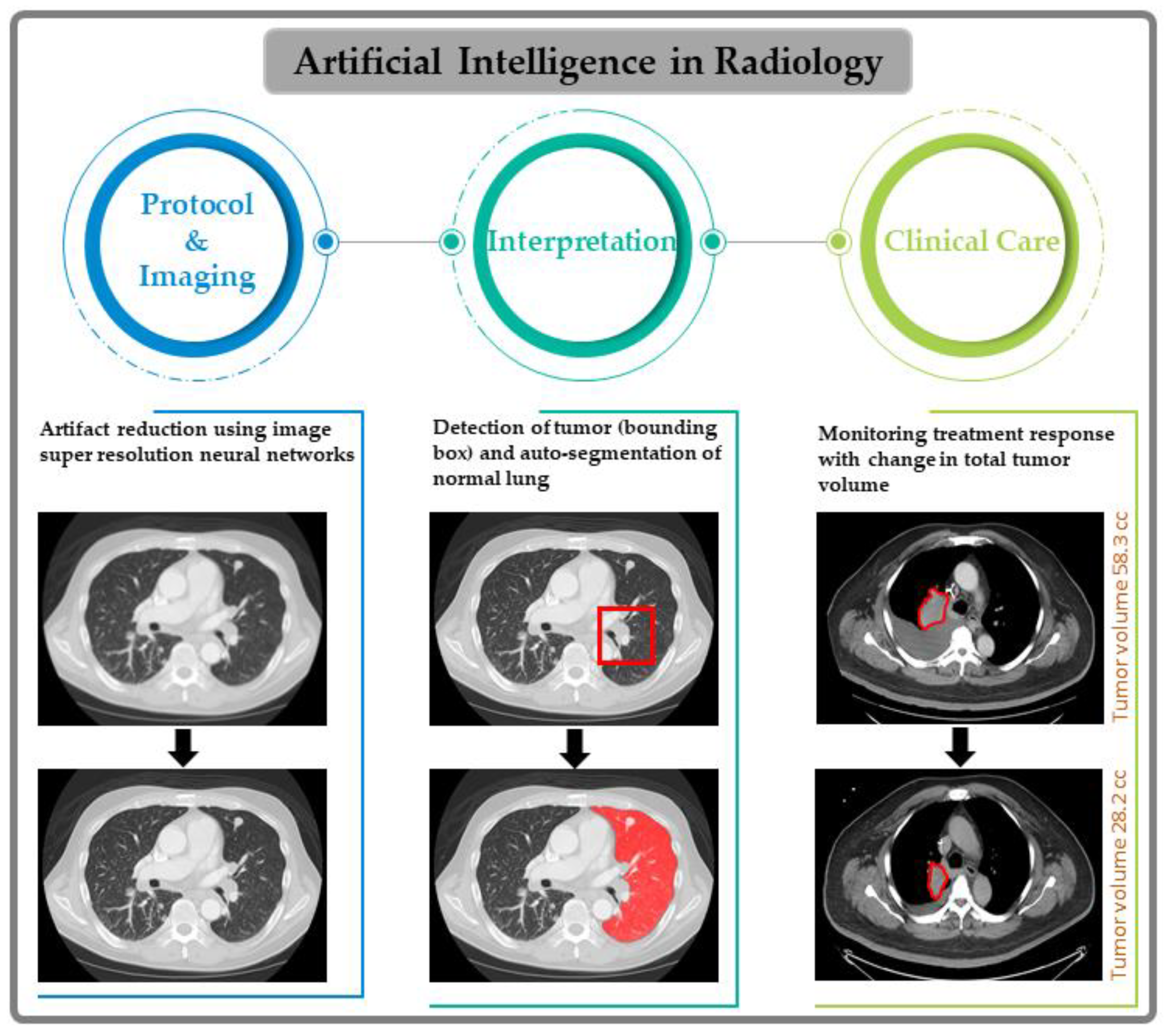 AI-powered interpretable imaging phenotypes noninvasively