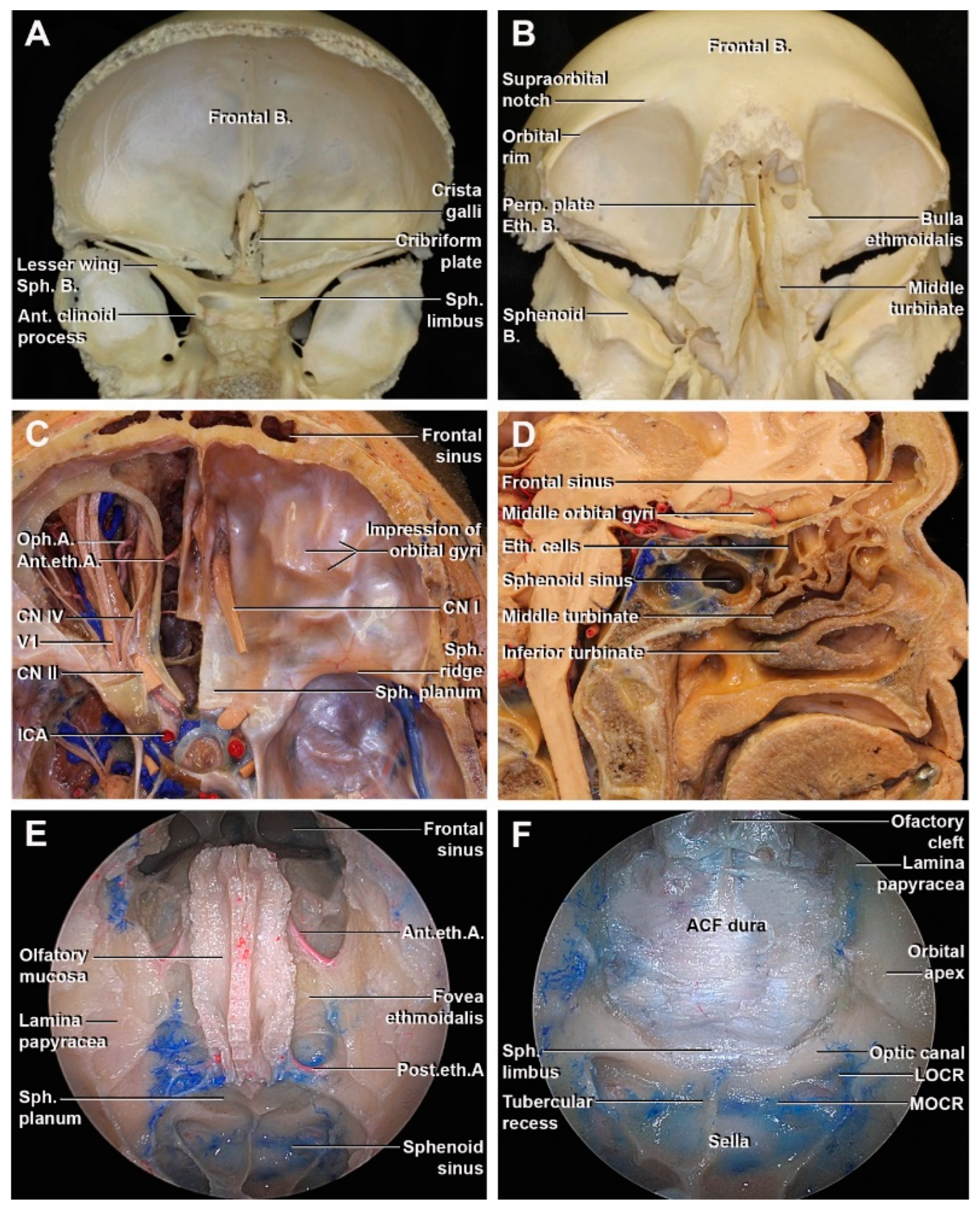 anterior skull anatomy