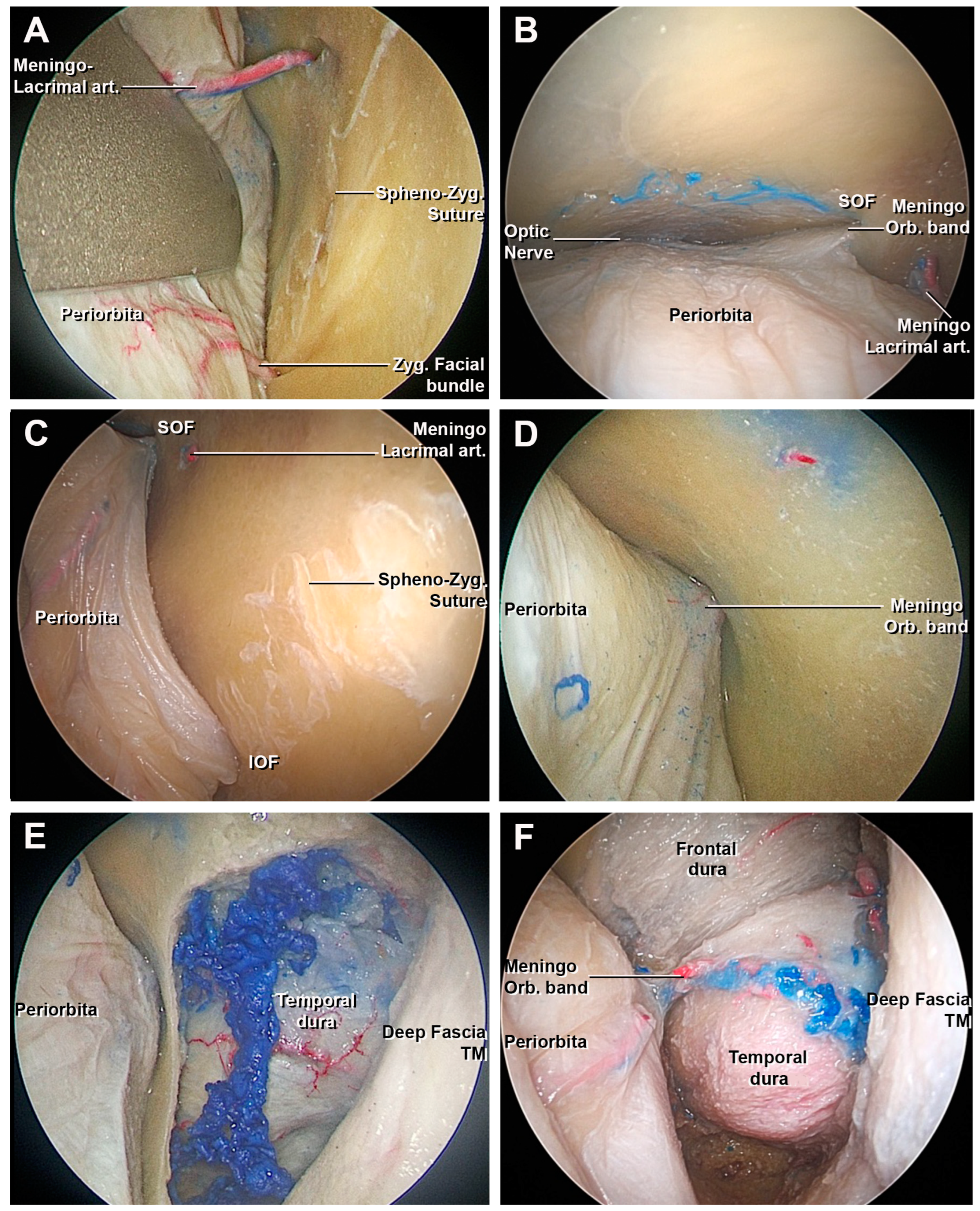 Surgical Anatomy of the Abdomen: A fundamental text with conceptual  illustrations for safe open and endoscopic surgery with contributions of