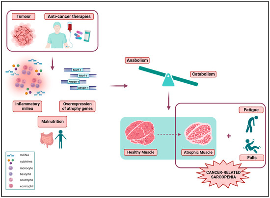 The Role of Exercise in Cancer-Related Sarcopenia and Sarcopenic Obesity