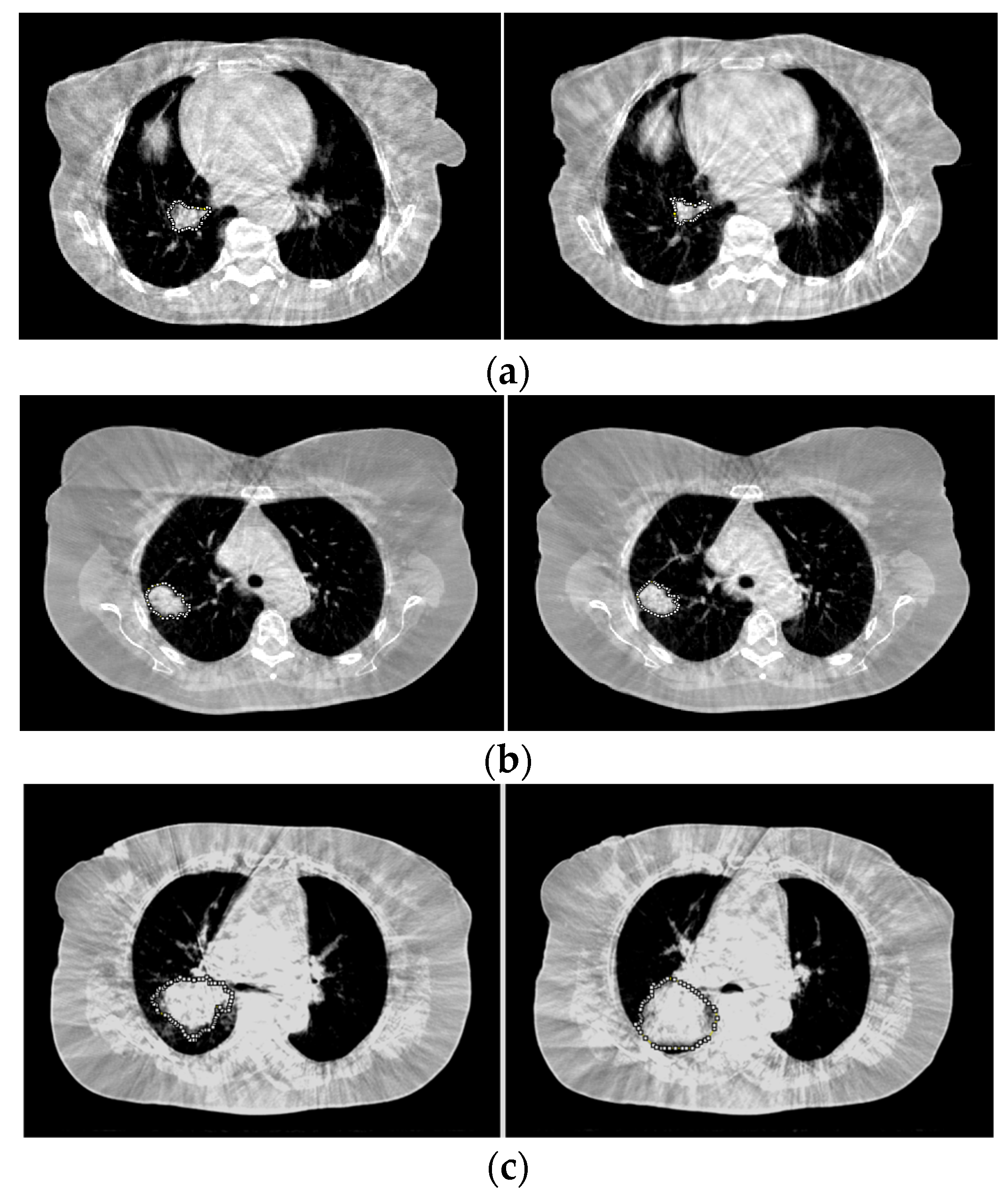 Cancers Free Full Text A Novel Method For Evaluating Early Tumor Response Based On Daily