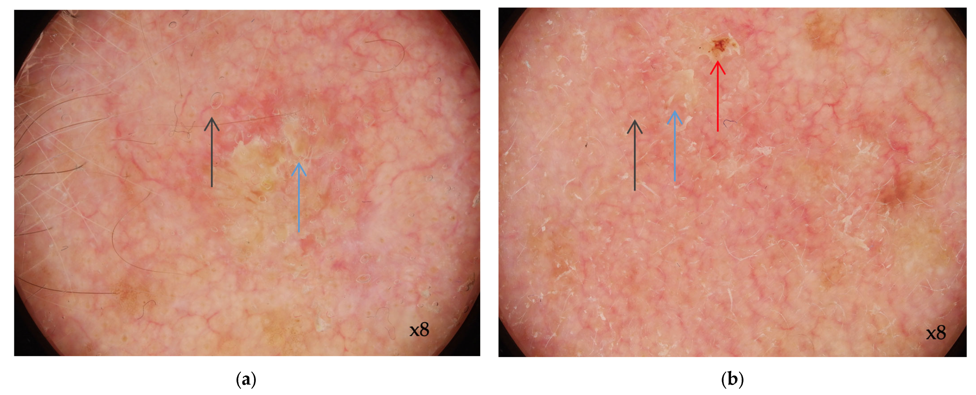 Digitally Enhanced Methods For The Diagnosis And Monitoring Of Digitally Enhanced Methods For The Diagnosis And Monitoring Of