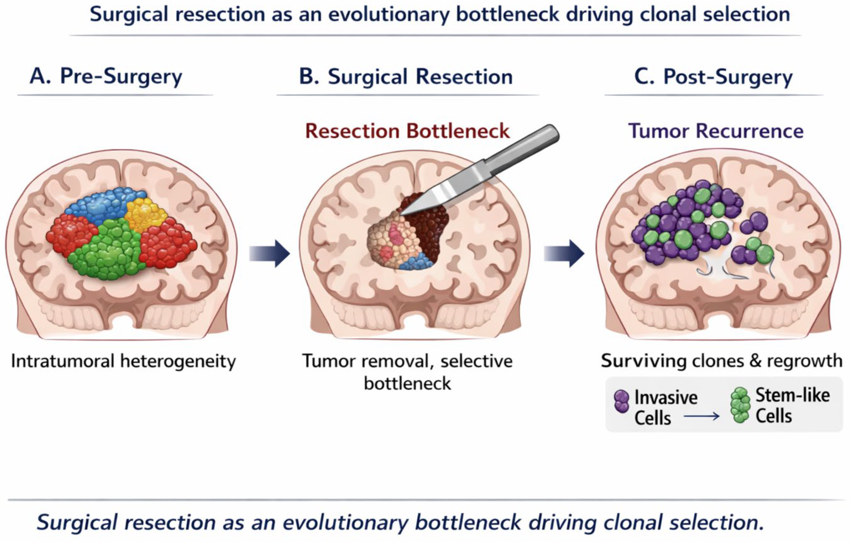 Beyond Resection: Surgery as an Evolutionary Bottleneck Shaping Tumor ...
