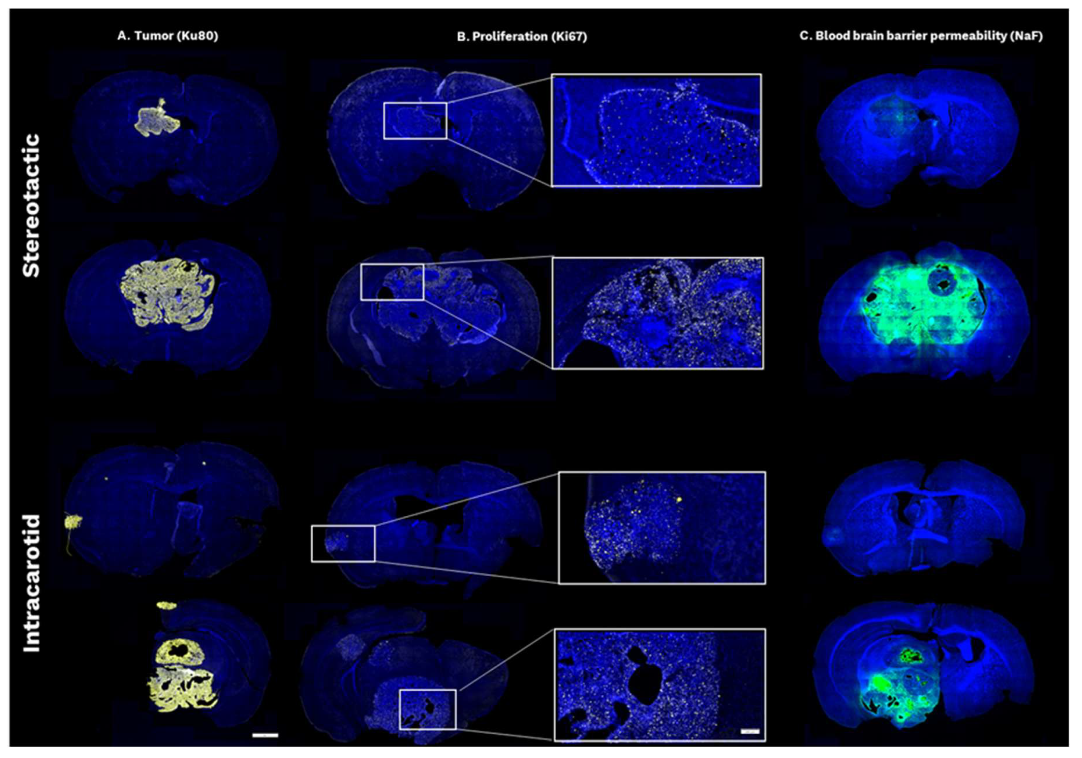 Evaluating the Translation Value of Two In Vivo Models for Breast ...
