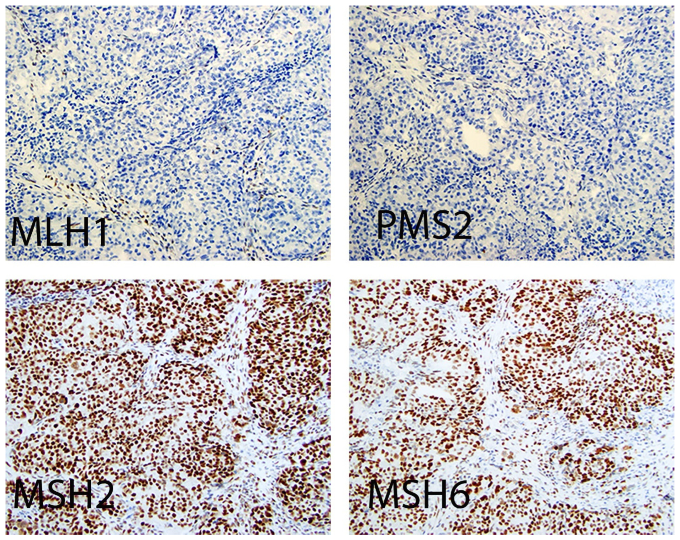 Biomarkers with Therapeutic or Prognostic Applications in Gynecologic ...