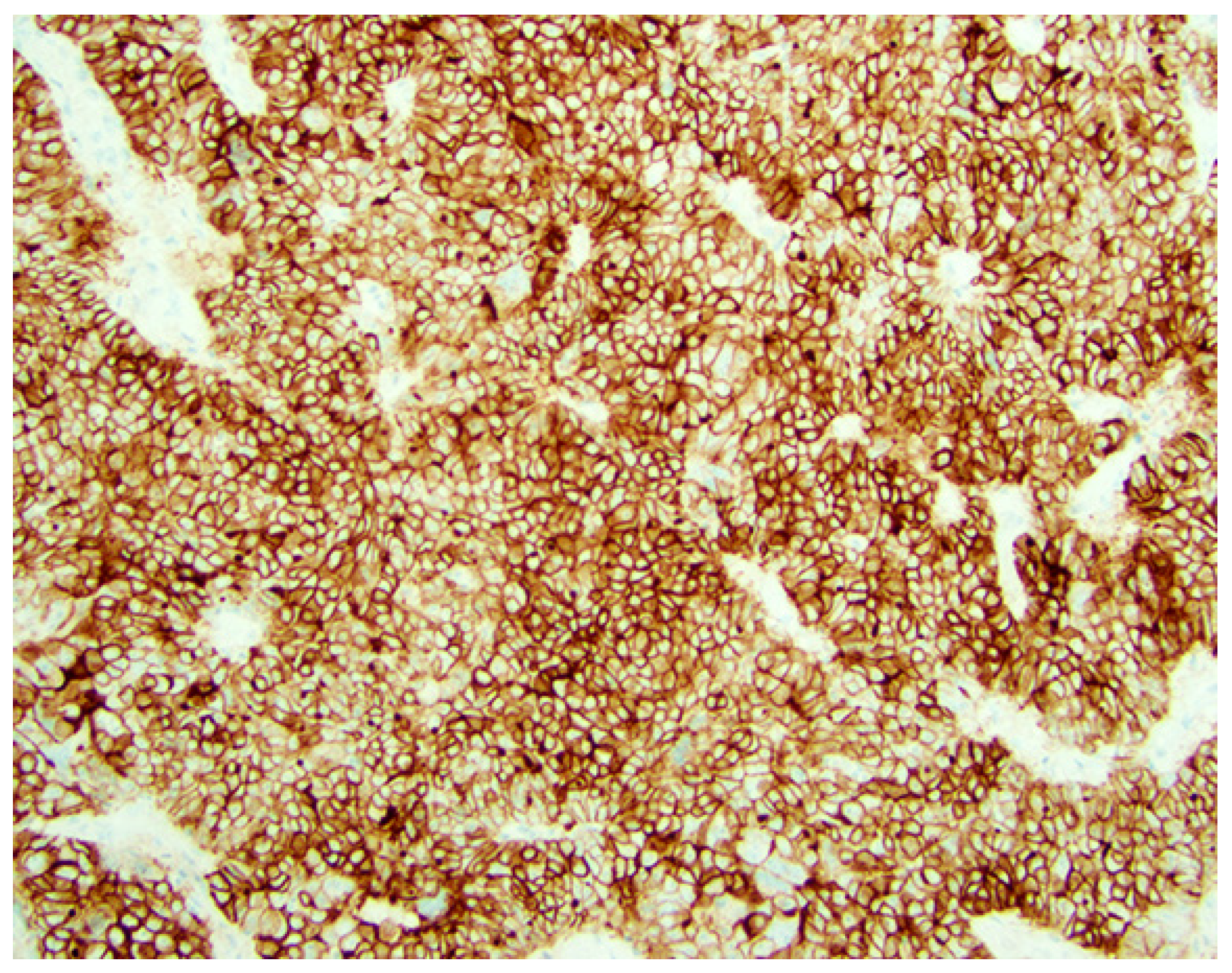 Biomarkers with Therapeutic or Prognostic Applications in Gynecologic ...