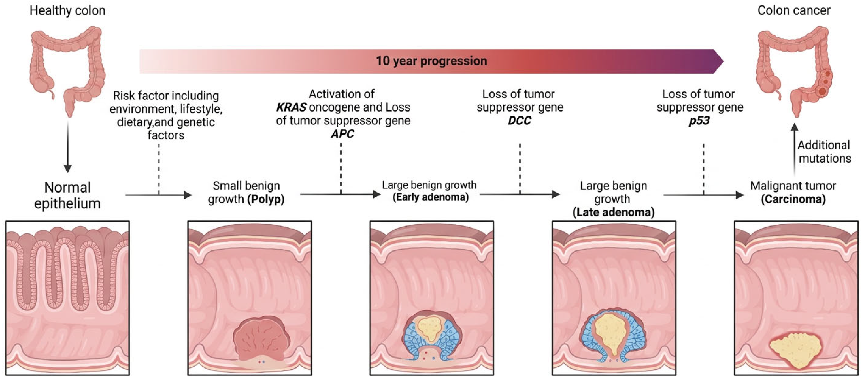 Multi Omics Integration in Colorectal Cancer: From Molecular Insights ...