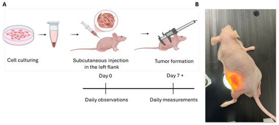 Establishment and Histopathological Characterization of a KYSE-30 Subcutaneous Xenograft Model of Esophageal Squamous Cell Carcinoma