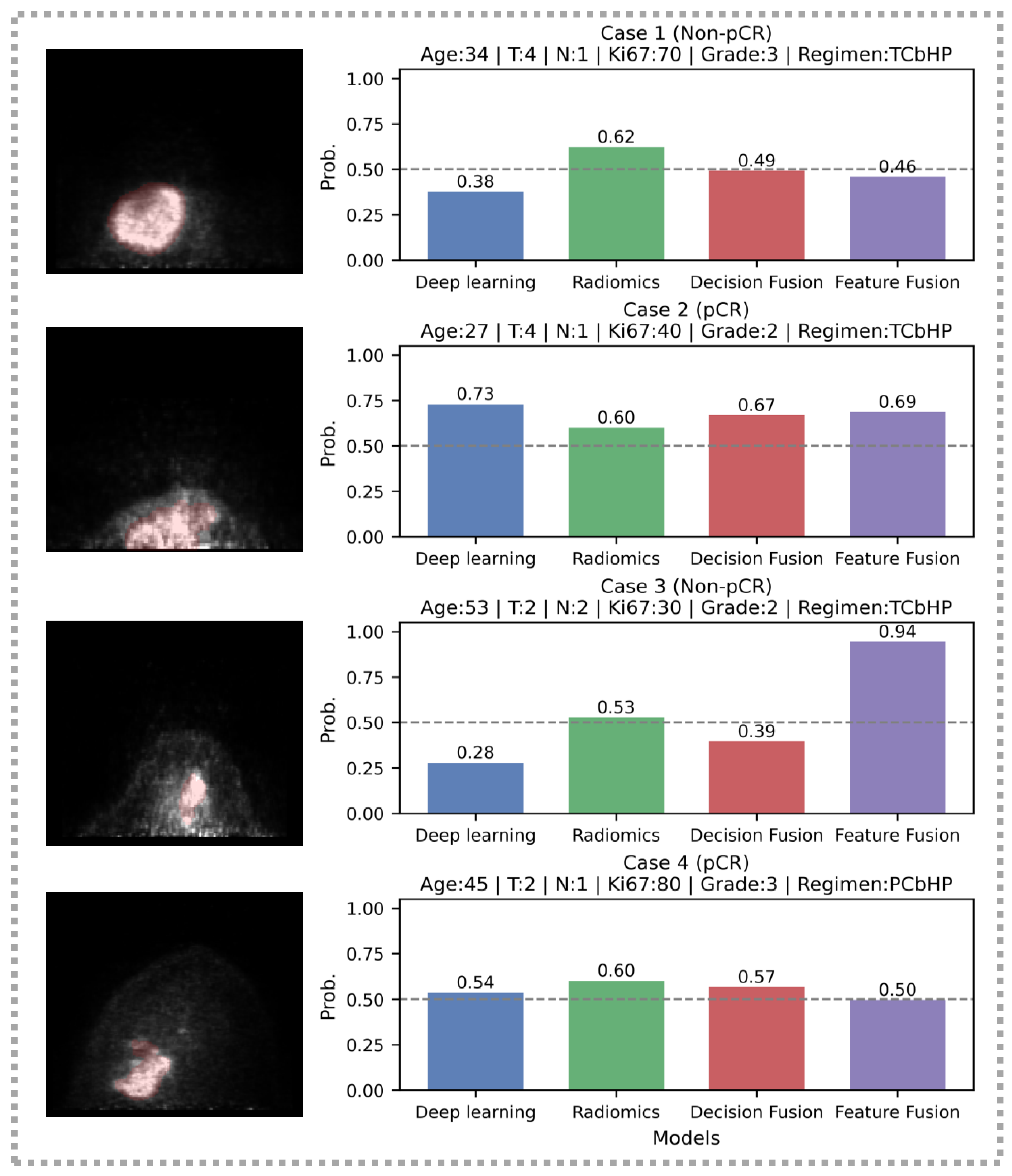 Dedicated Breast PET-Based Deep Learning Radiomics for Prediction of ...