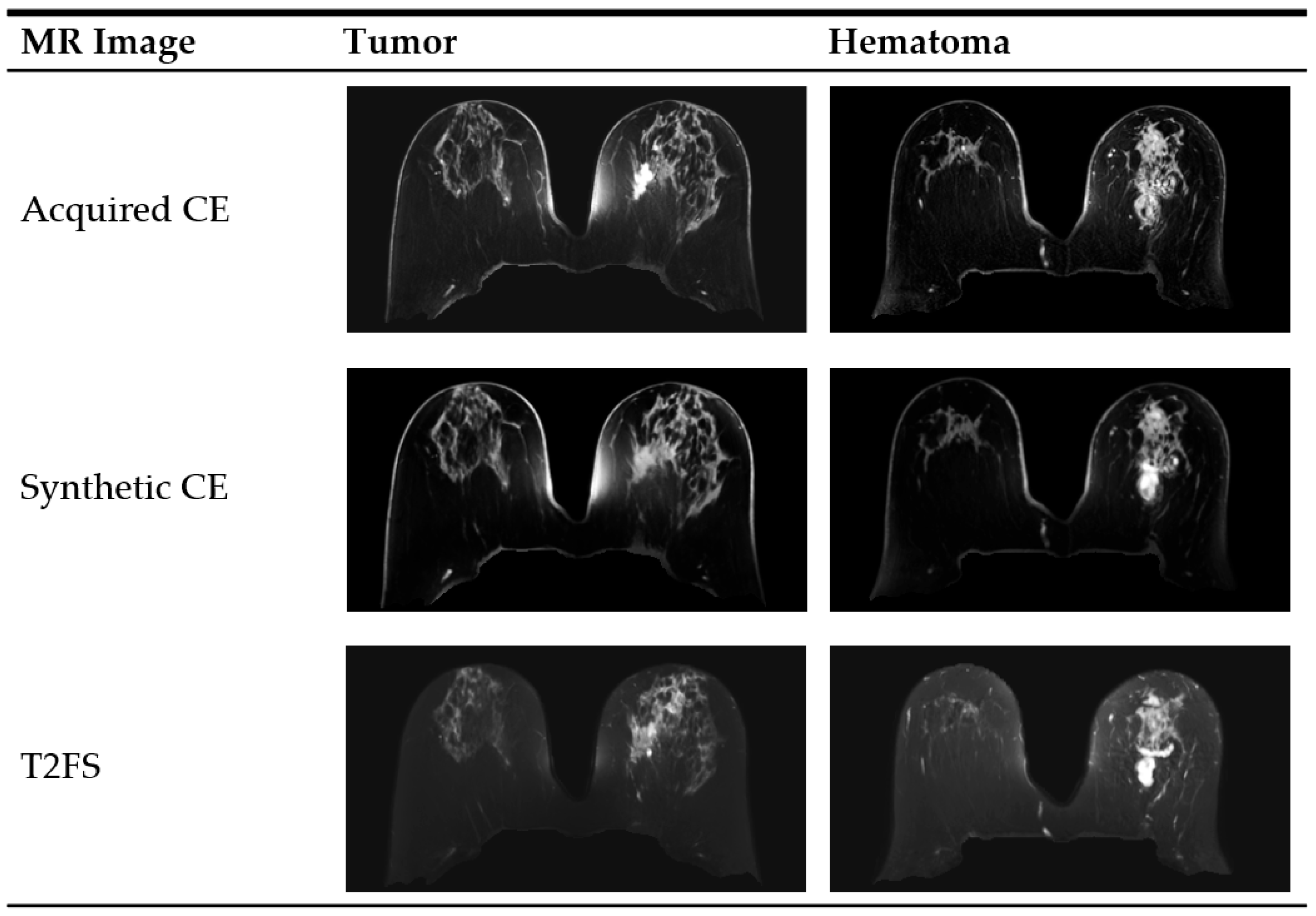 Deep Learning-Based Synthetic Contrast-Enhanced Breast MRI for ...