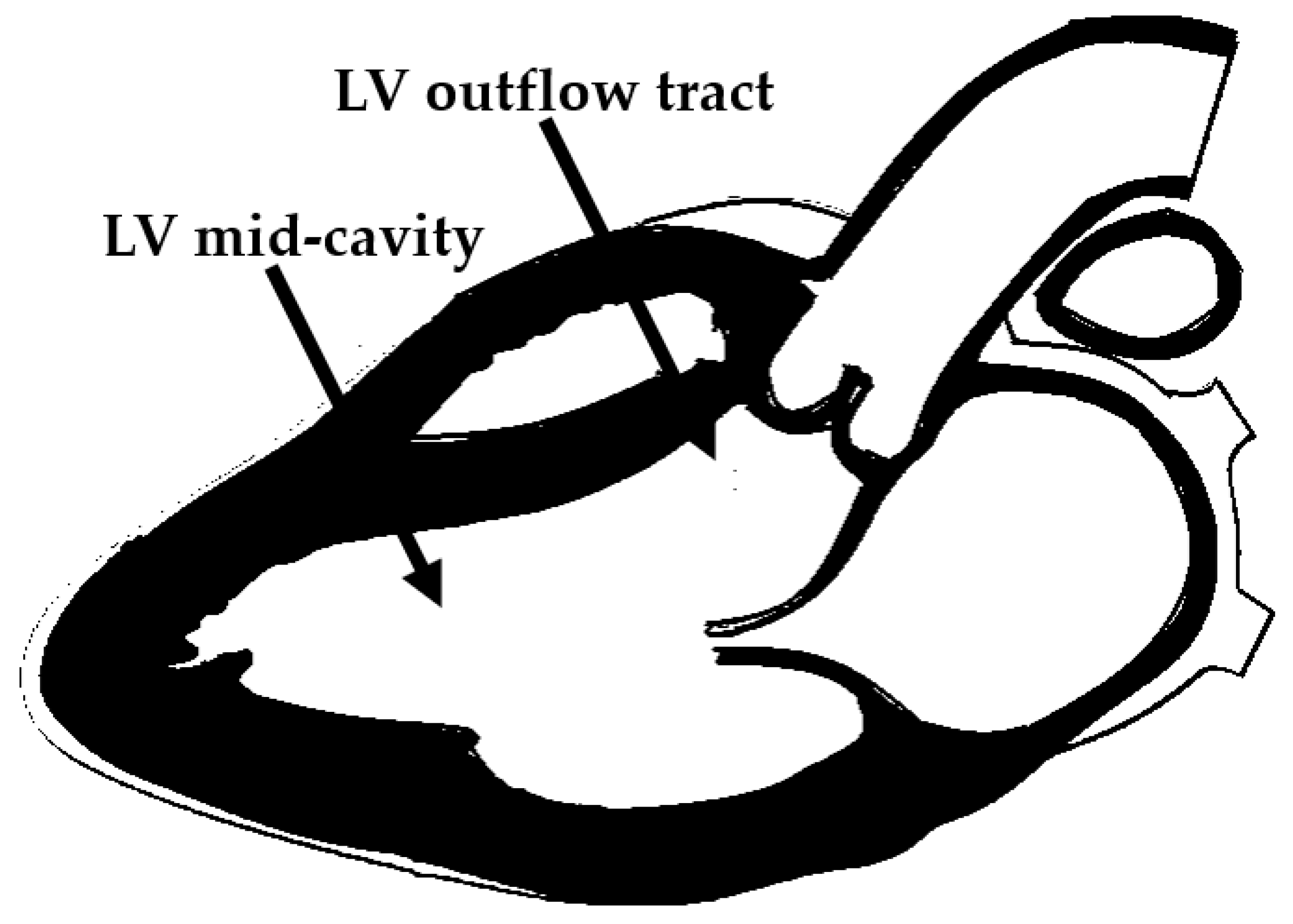 Measuring Left Ventricular Outflow Tract Signal Gradient in