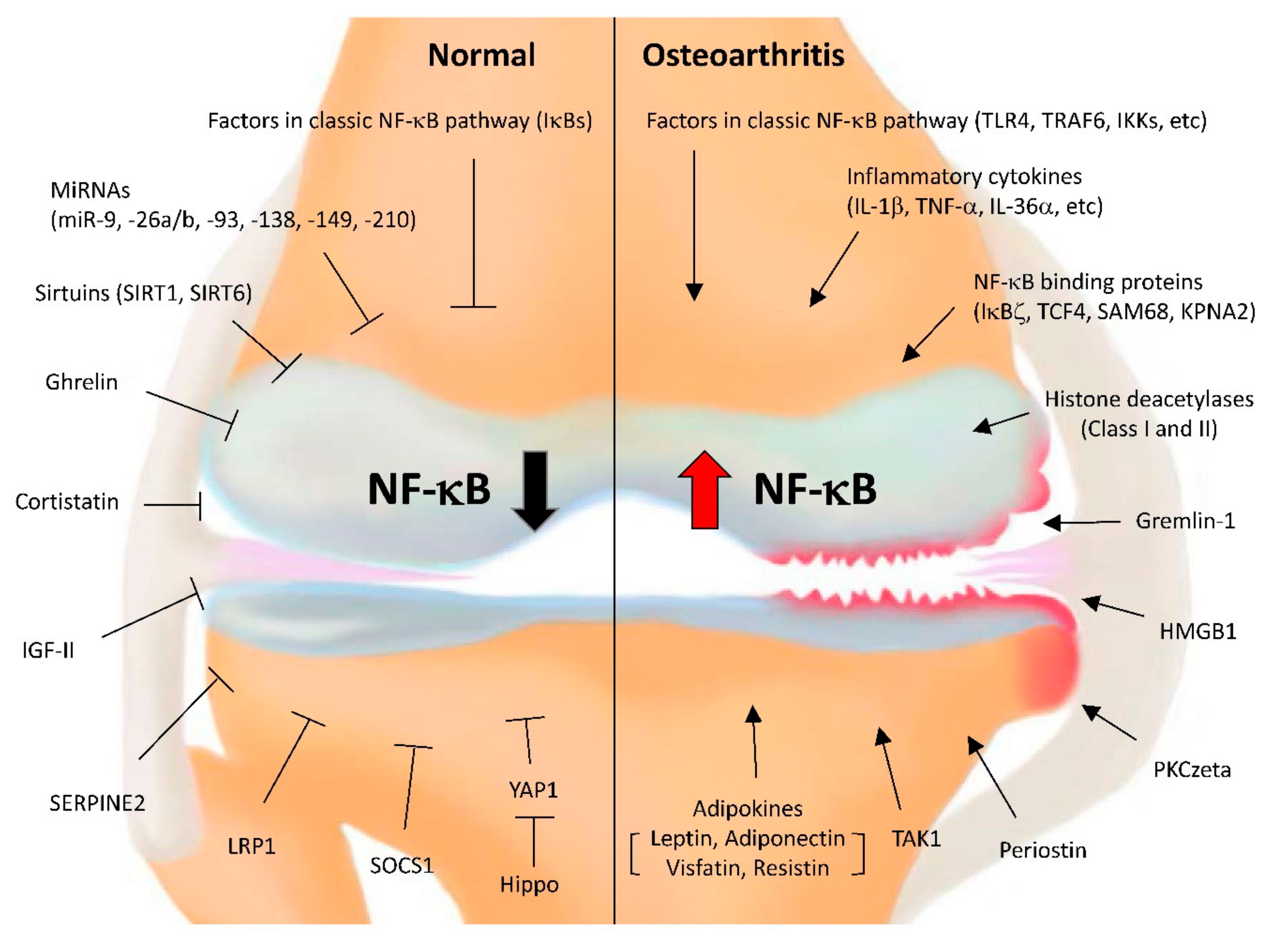 hulp Weglaten vertalen Cells | Free Full-Text | NF-κB Signaling Pathways in Osteoarthritic  Cartilage Destruction