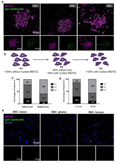 Cells | Free Full-Text | Myocyte Enhancer Factor 2C as a New Player in ...