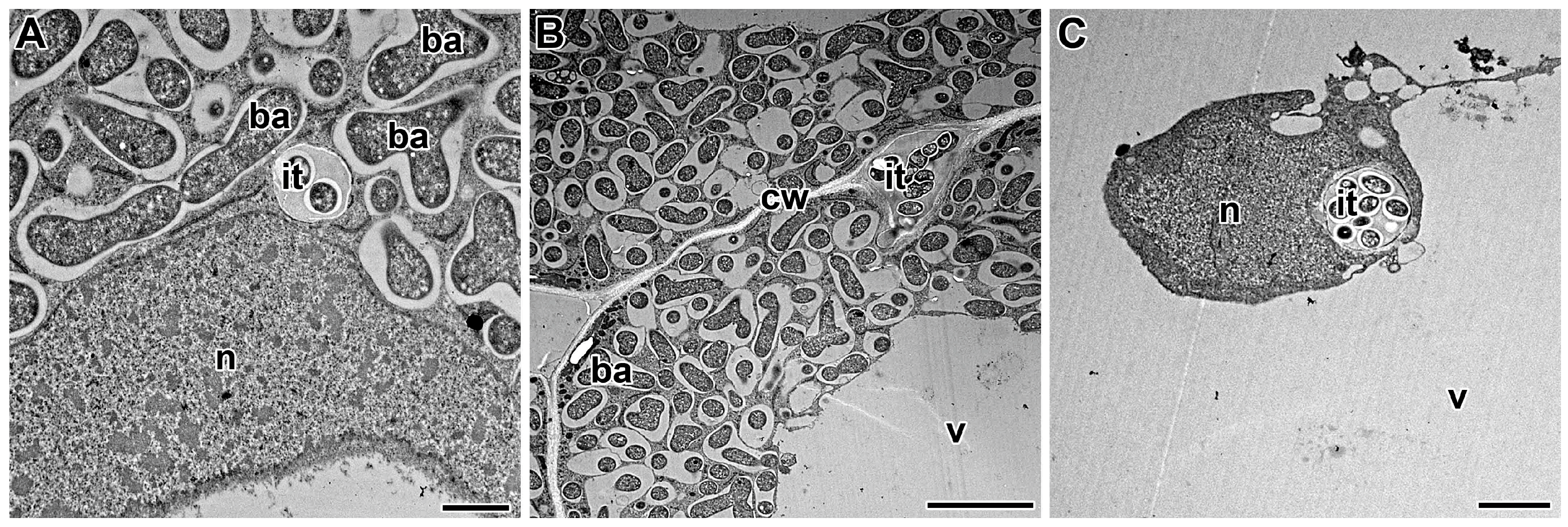 Cells Free Full-Text Structure and Development of the Legume-Rhizobial Symbiotic Interface in Infection Threads pic