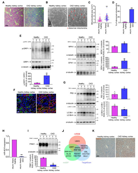 Cells | Free Full-Text | Melatonin Treatment Improves Renal Fibrosis ...