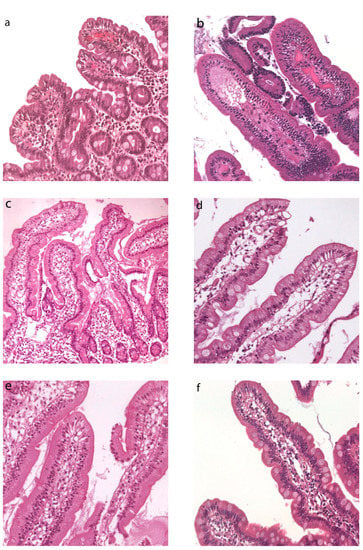 Cells | Free Full-Text | New Insights into Intestinal Permeability in ...