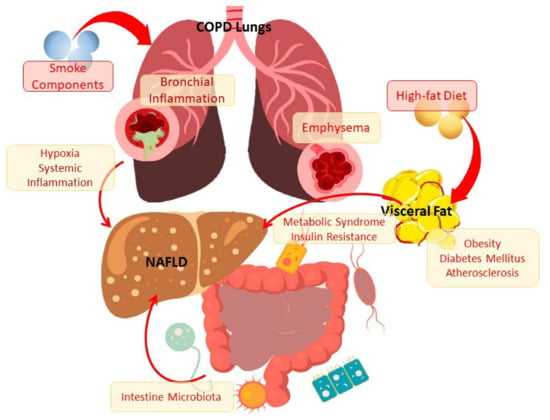 Cells Free Full Text Lipid Metabolism Disorders In The Comorbid Course Of Nonalcoholic Fatty