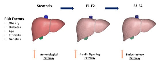 Cells | Free Full-Text | Progressive Liver Fibrosis in Non-Alcoholic ...