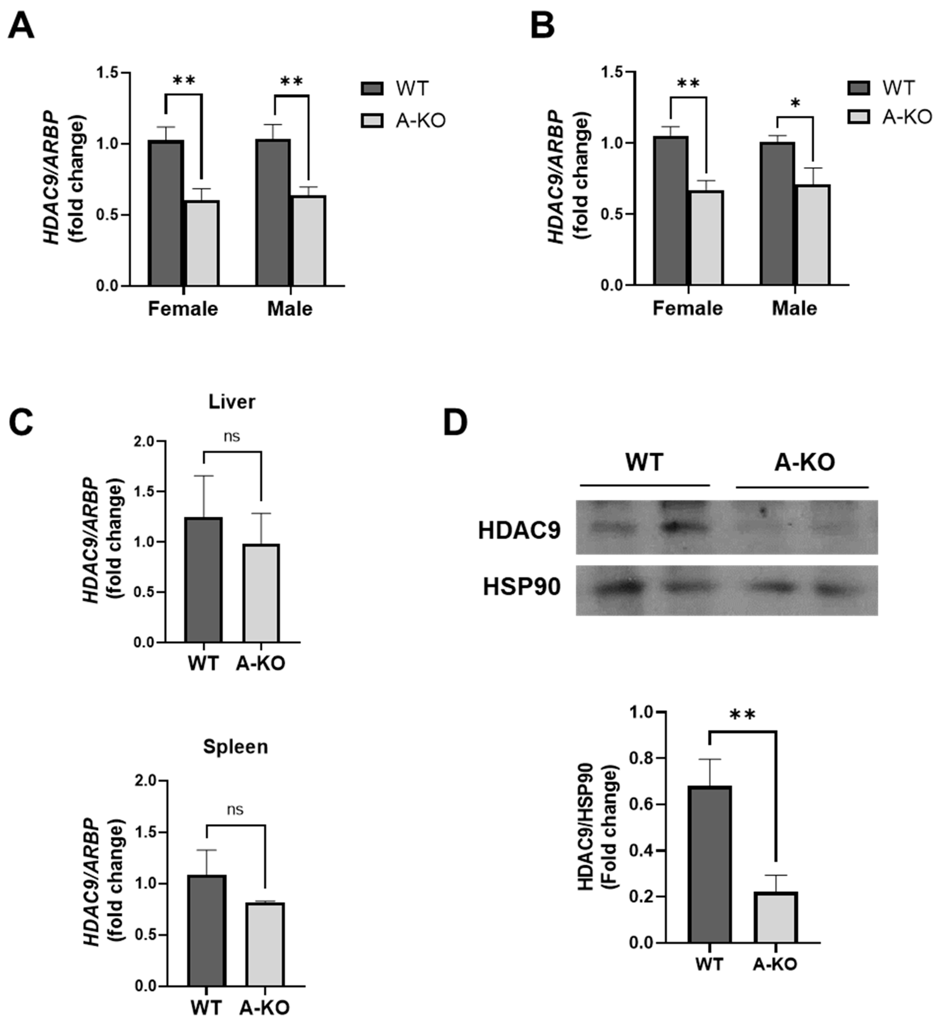 Cells Free Full Text Sex Dependent Role Of Adipose Tissue Hdac9 In Diet Induced Obesity And 4412