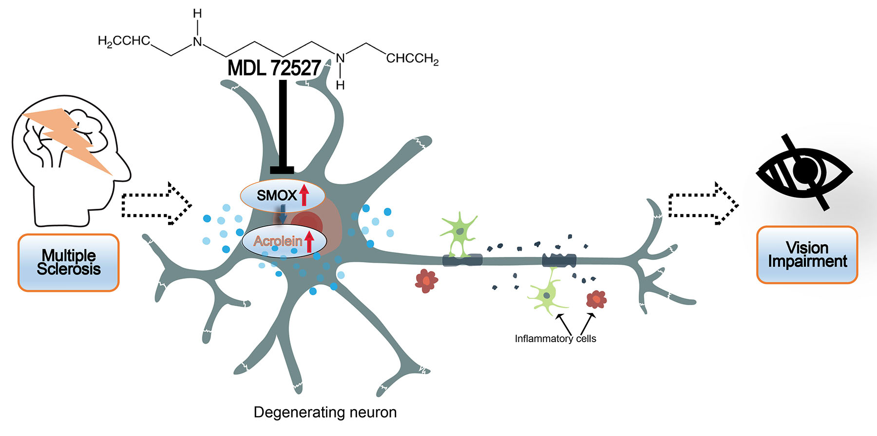 Cells Free Full-Text Treatment with MDL 72527 Ameliorated Clinical Symptoms, Retinal Ganglion Cell Loss, Optic Nerve Inflammation, and Improved Visual Acuity in an Experimental Model of Multiple Sclerosis pic