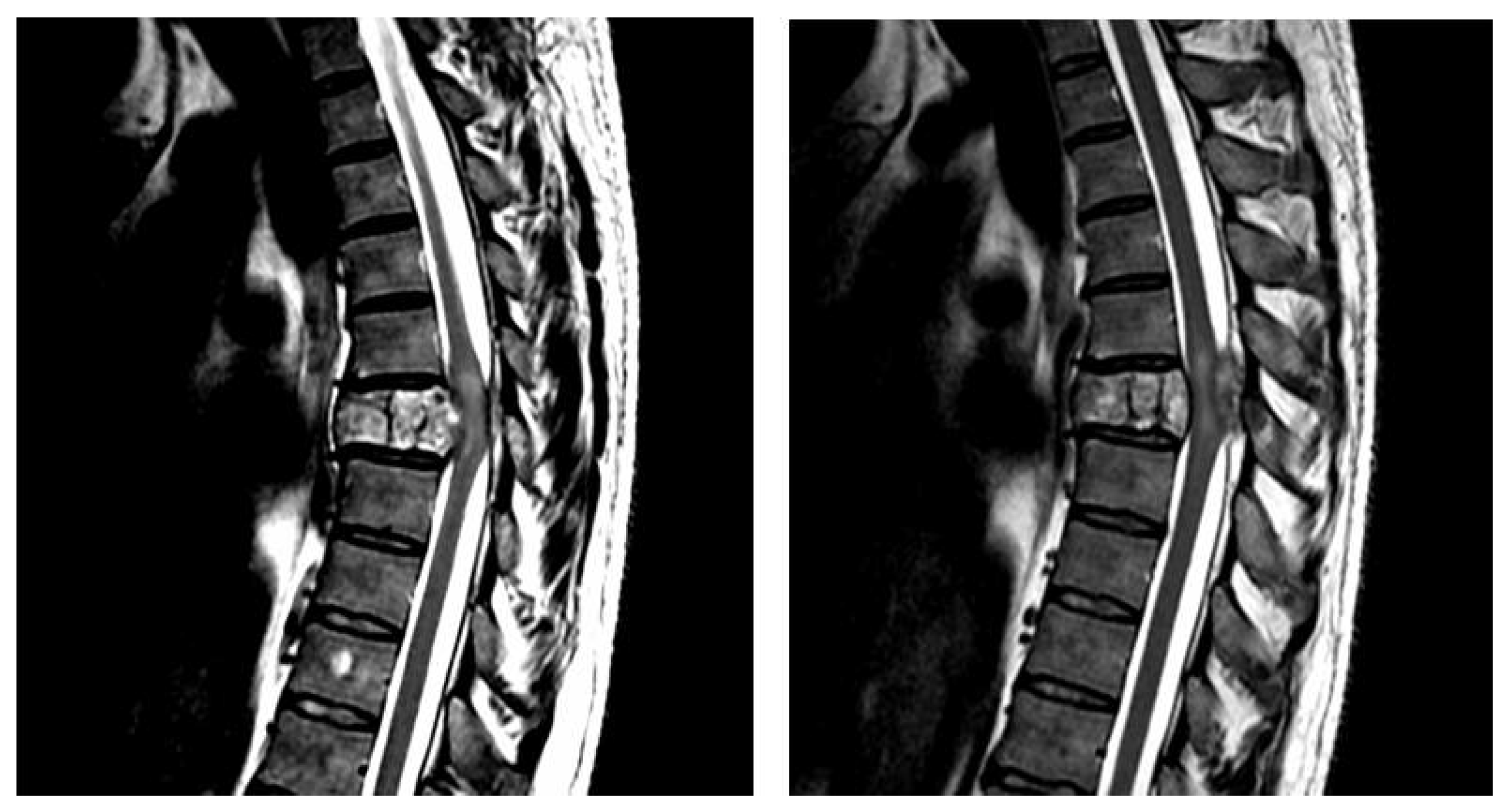 2770px x 1492px - Cells | Free Full-Text | Molecular Mechanisms and Clinical Application of  Multipotent Stem Cells for Spinal Cord Injury