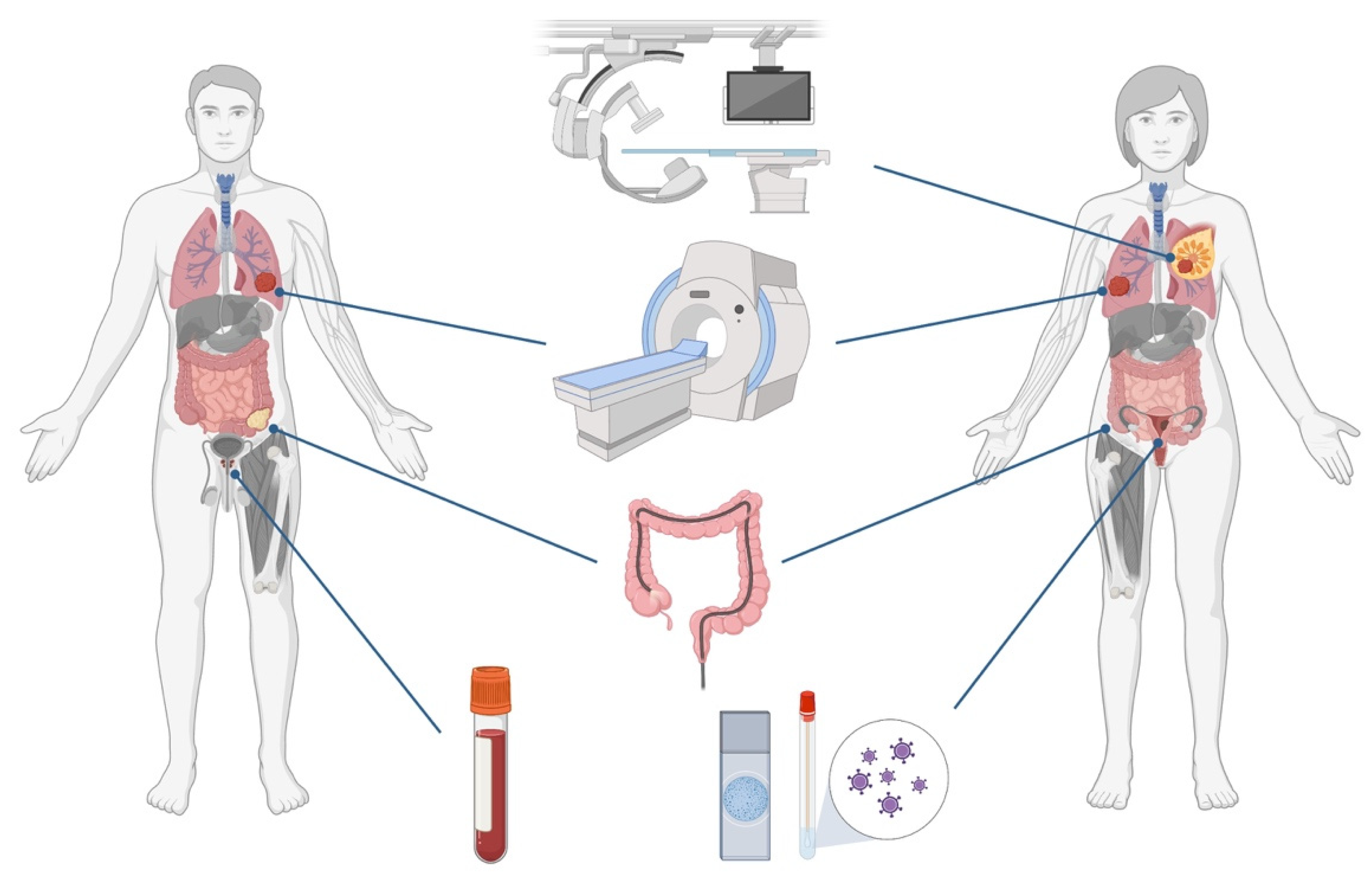 Simplifying Cancer Detection using point-of-care Technologies - FutureBridge