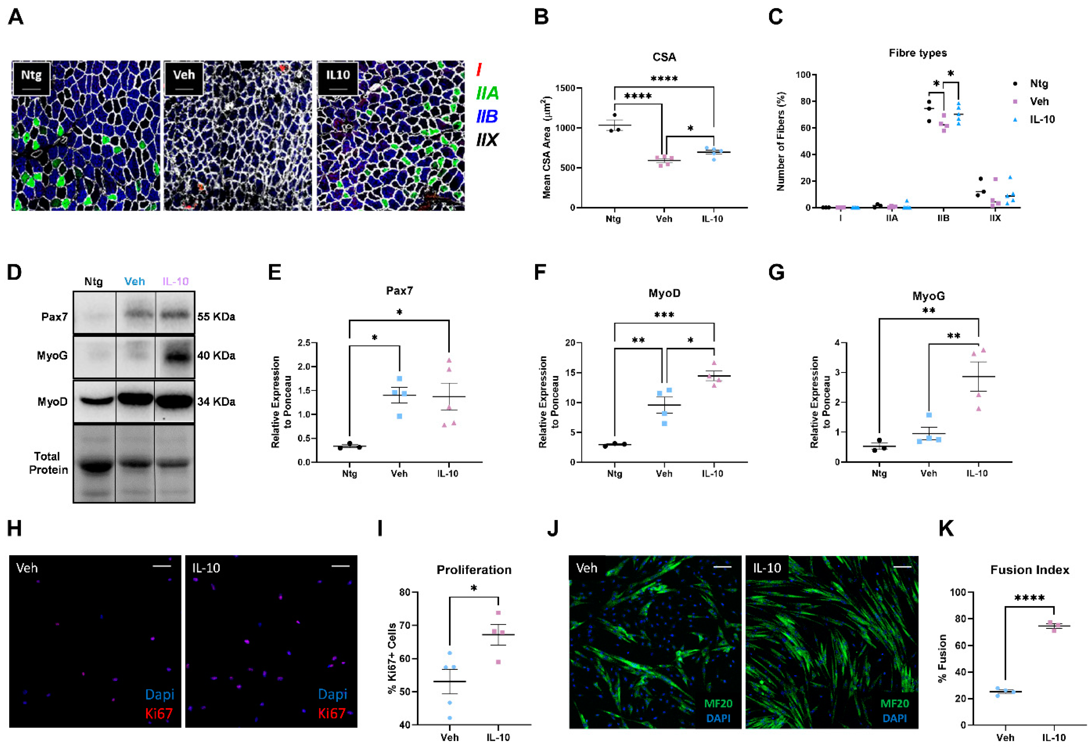 Cells Free Full-Text Intramuscular IL-10 Administration Enhances the Activity of Myogenic Precursor Cells and Improves Motor Function in ALS Mouse Model