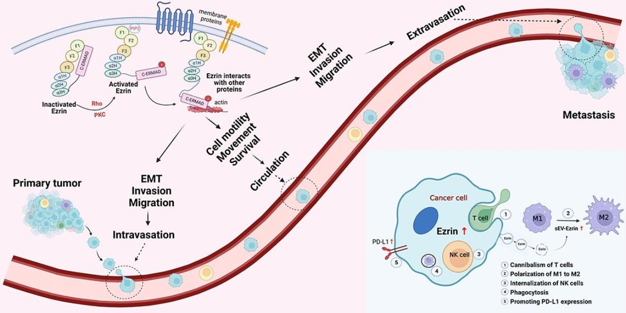 Cells | Free Full-Text | Ez-Metastasizing: The Crucial Roles of Ezrin ...