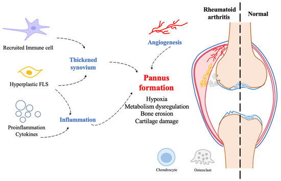 NF-κB: blending metabolism, immunity, and inflammation: Trends in Immunology