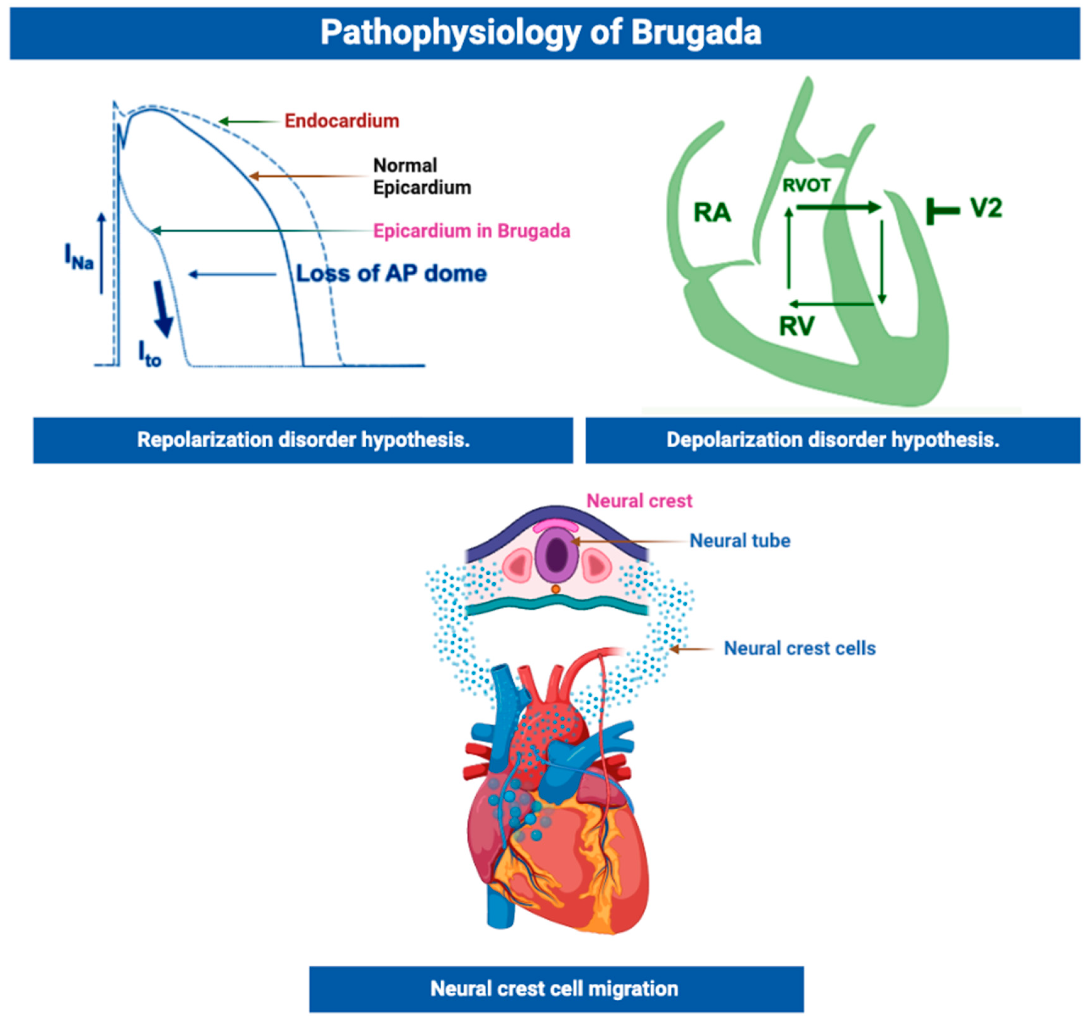 Genetic And Molecular Mechanisms In Brugada Syndrome Genetic And Molecular Mechanisms In Brugada Syndrome