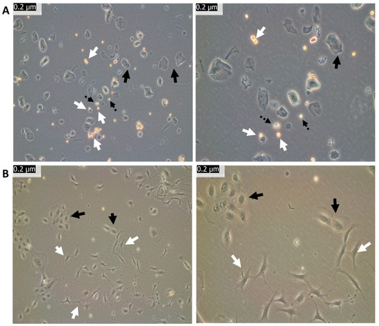 Human Oral Mucosa as a Potentially Effective Source of Neural Crest ...